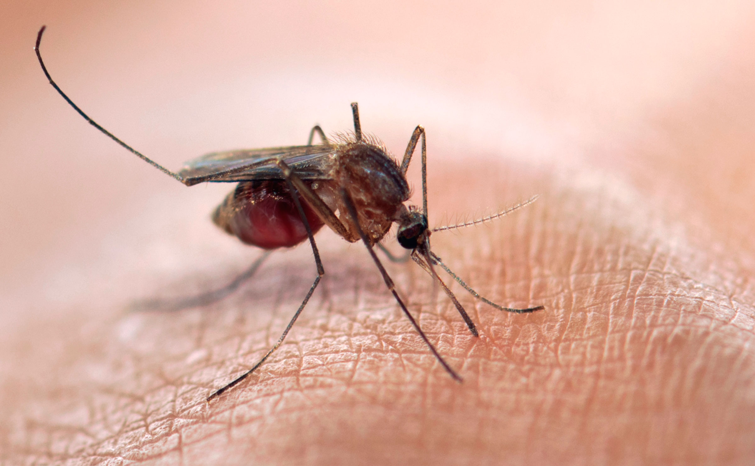 Zika no es sinónimo de microcefalia